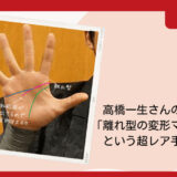 高橋一生さんの右手｜離れ型の変形マスカケという超レア手相！？